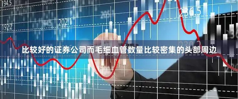 比较好的证券公司而毛细血管数量比较密集的头部周边